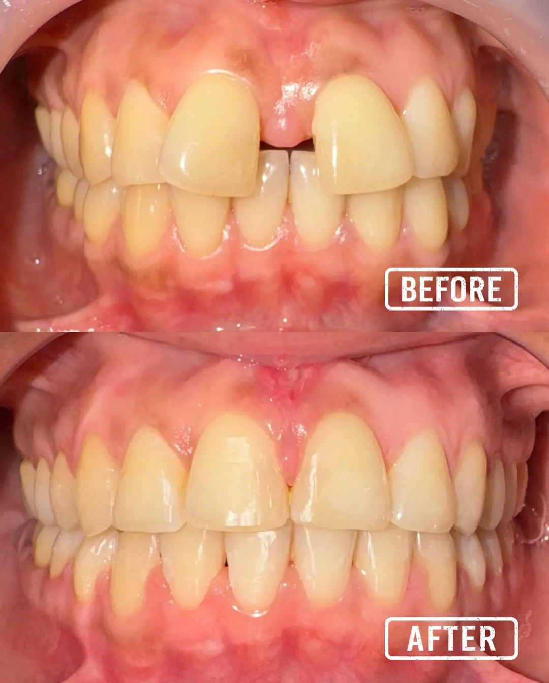 Before After Treatment