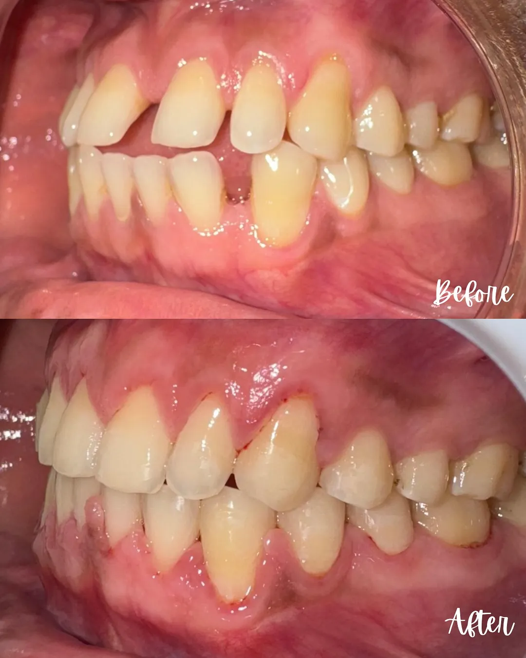 Before After Treatment