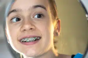 Lingual Braces Dubai: The Invisible Way to Straighten Teeth Without Anyone Knowing